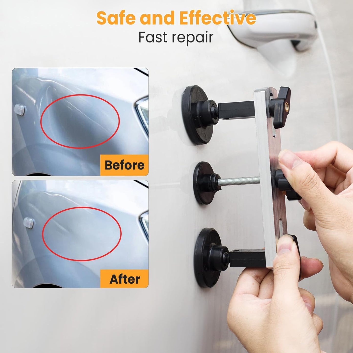 Dent Puller, Paintless Dent Removal Kit – All-in-One Car Dent Puller Kit with Bridge Puller–Dent Repair for Hail, Dings